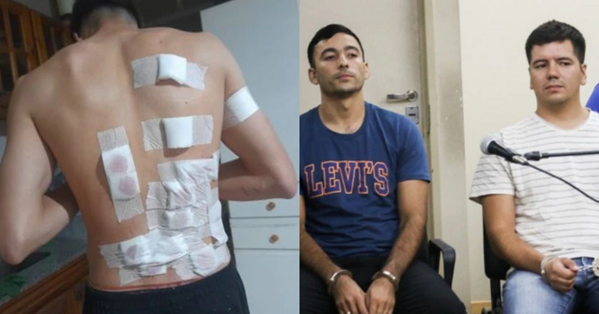 Caso judicial por el ataque a un joven baleado por la espalda en Chimbas