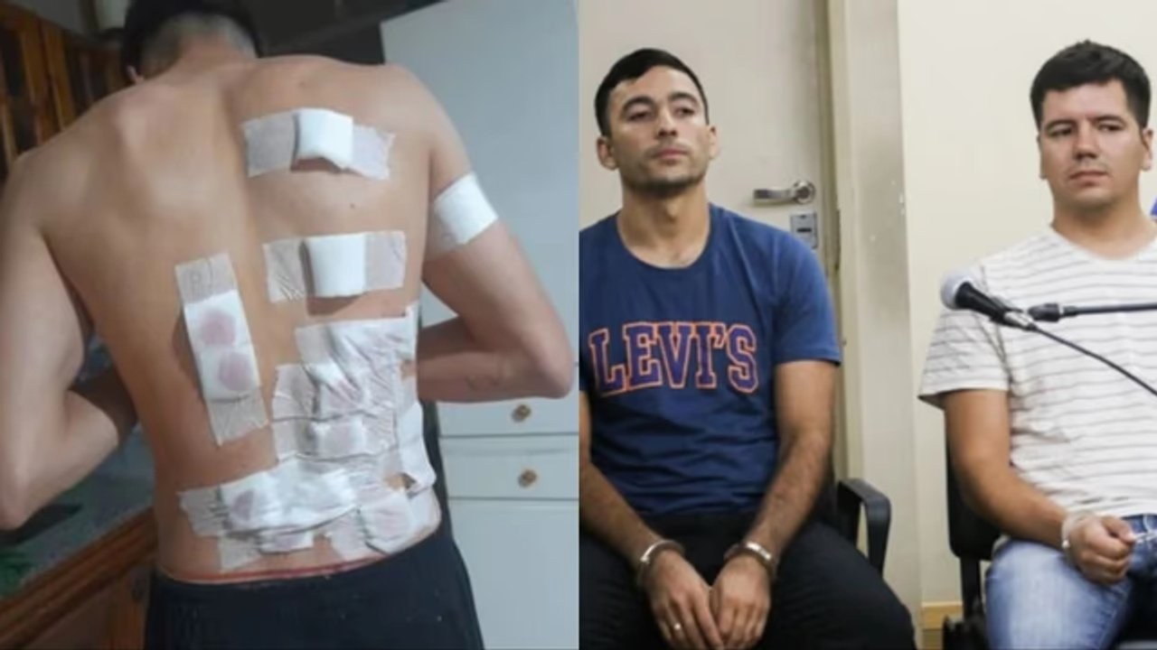 La espalda vendada del joven herido en Chimbas y los dos policías acusados sentados en el juicio