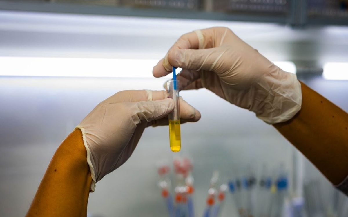 Campaña de controles gratuitos por cáncer de próstata en Santa Lucía