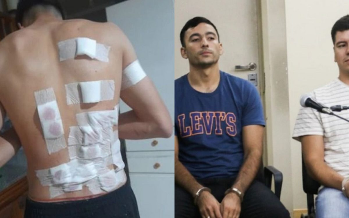 Caso judicial por el ataque a un joven baleado por la espalda en Chimbas