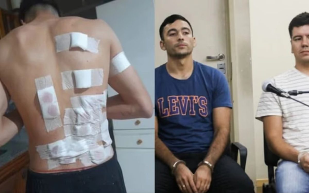 La espalda vendada del joven herido en Chimbas y los dos policías acusados sentados en el juicio